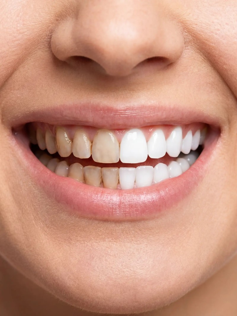 Before and After Results